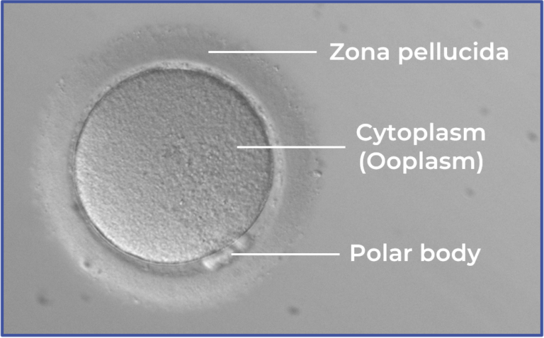 Image of a normal looking oocyte