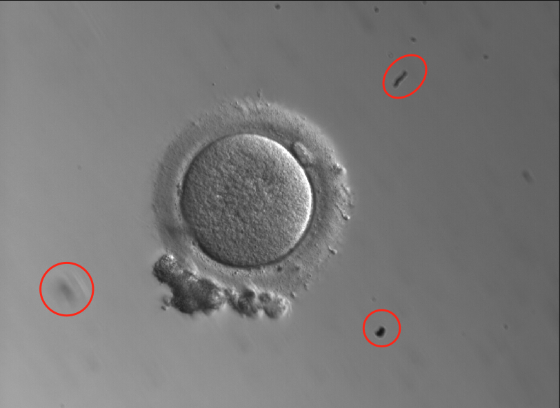 Oocyte in dish with debris