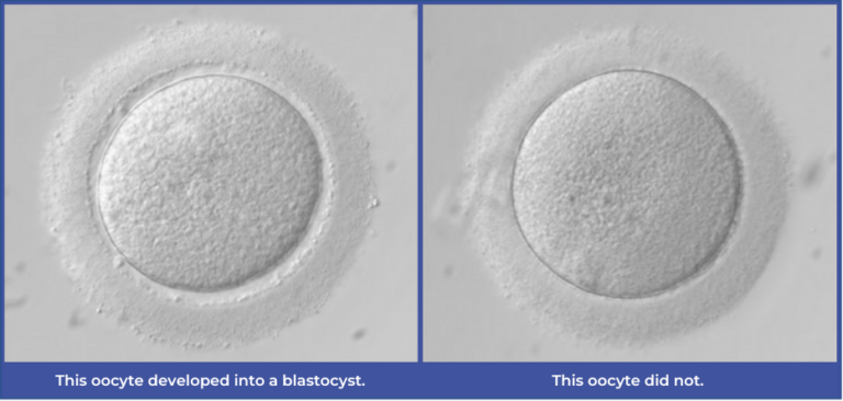 AI is able to classify a poor quality oocyte from a good quality oocyte.