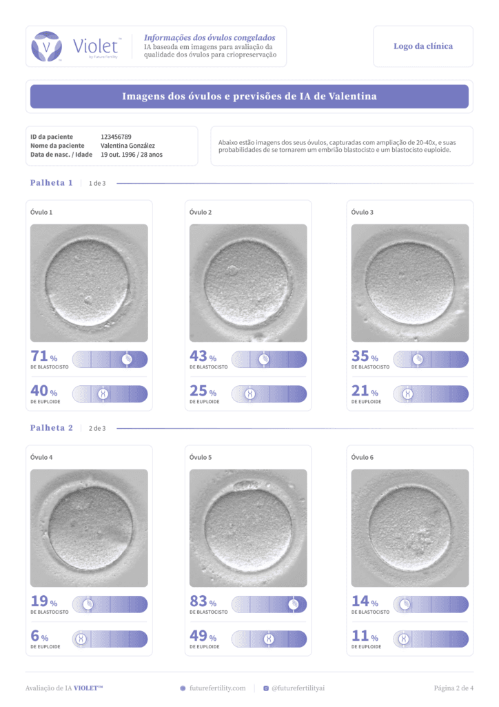 Page two of the VIOLET oocyte quality report for egg freezing patients