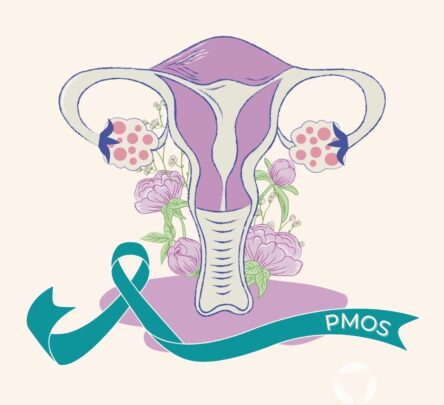 PMOS Awareness Ribbon and Illustration of Ovaries