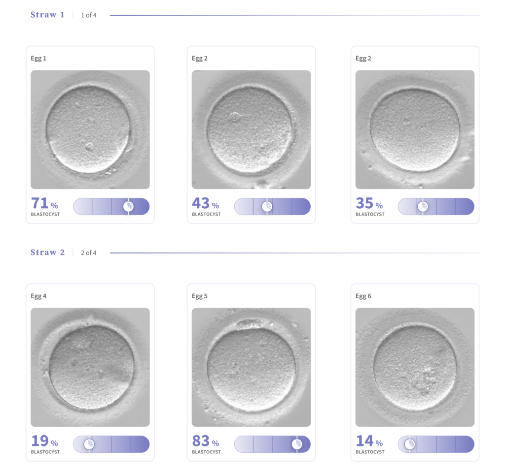 Patient Use Case: Using VIOLET™ to Manage Expectations and Guide Cycle ...